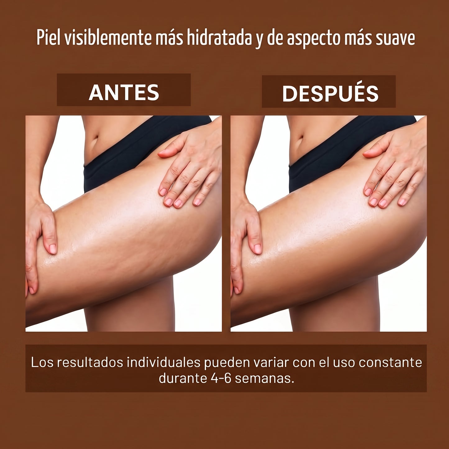 Auralia® Elixir Anticelulitis