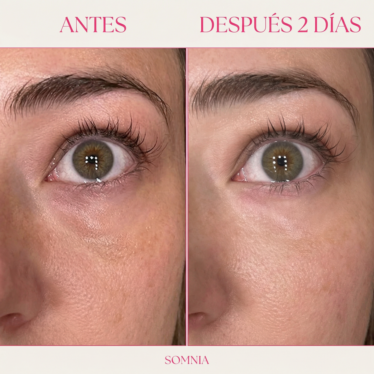 Somnia® Mirada Descansada